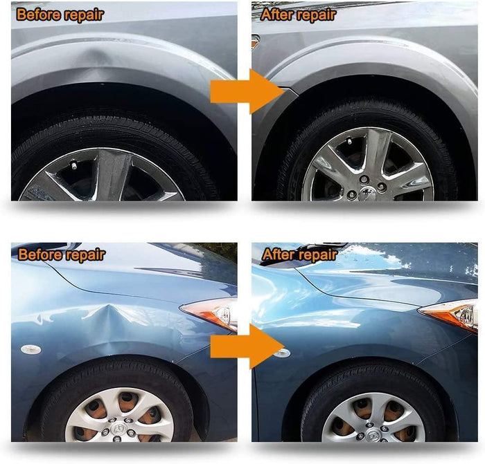 Auto Body Repair Tool Kit, Car Dent Puller with Double Pole Bridge Dent Puller, Glue Puller Tabs, Glue Shovel - Rokcar